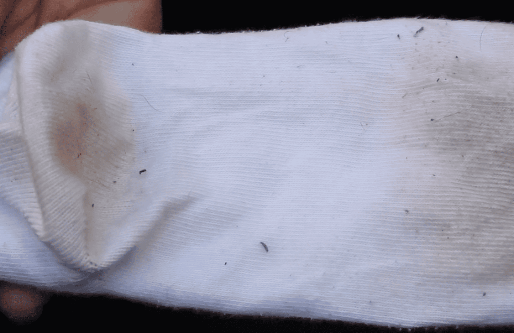 Entendiendo el problema de manchas y amarilleo en la ropa blanca